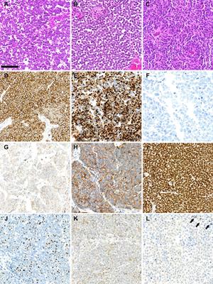 Histogenesis of Merkel Cell Carcinoma: A Comprehensive Review